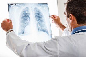 lung infection and cystic fibrosis