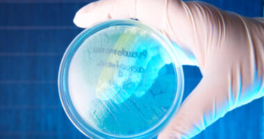 CF bacterial infections
