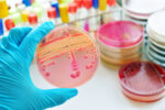 Harmful gut bacteria in CF