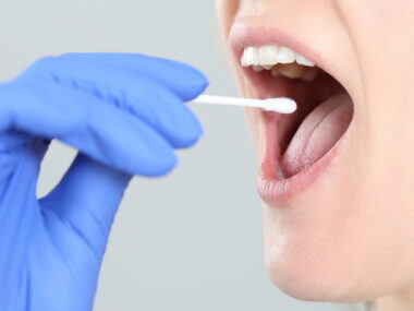 DNA screening