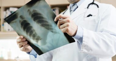 Cystic fibrosis survey