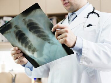 Cystic fibrosis survey