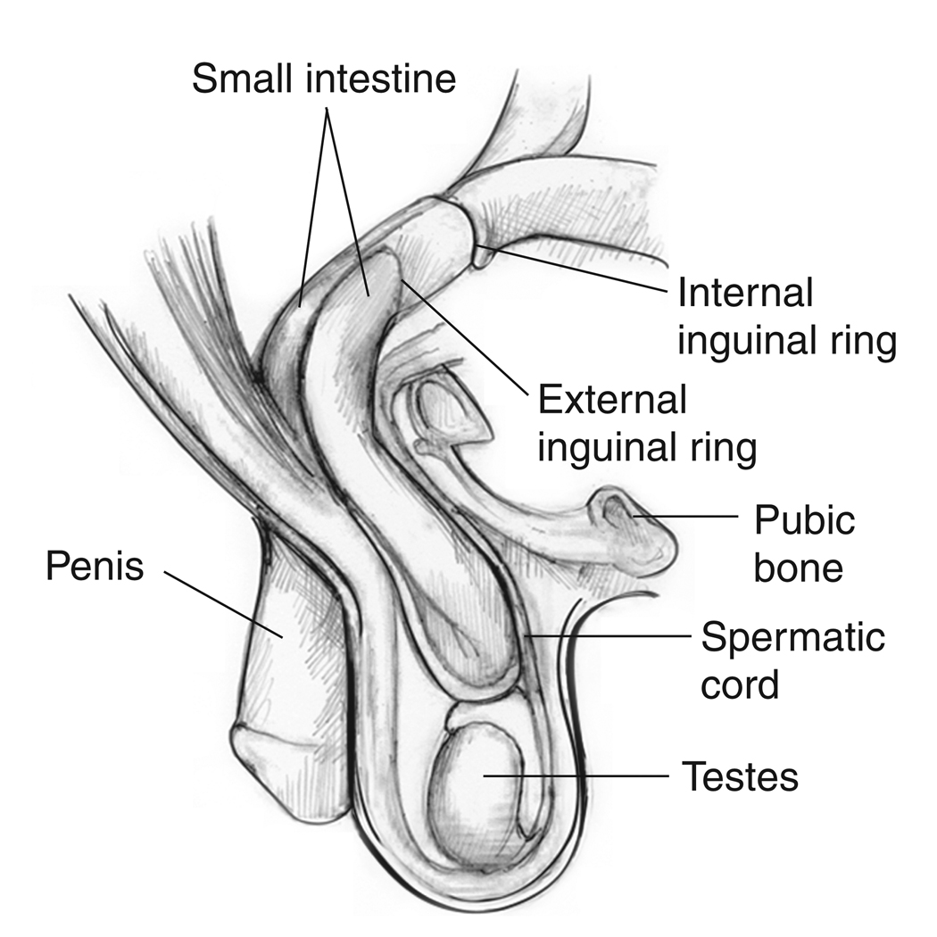 The Penis cyst surgery excellent Phrase Penis cyst surgery