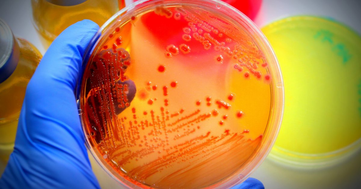 Antibiotic Combo Kills M. Abscessus Bacteria, Common in CF, Study Says