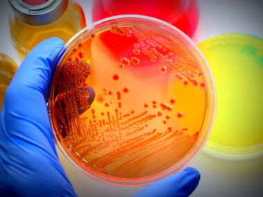 M. abscessus