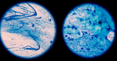 Phase 2 nitric oxide trial
