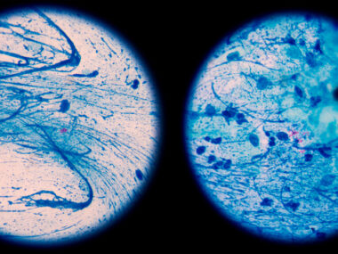 Phase 2 nitric oxide trial