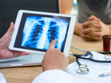 lung infections, P. aeruginosa