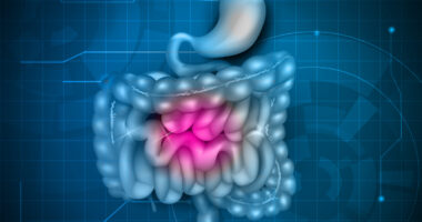 MS1819-SD first patients dosed