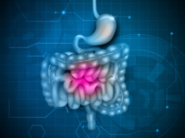 MS1819-SD first patients dosed