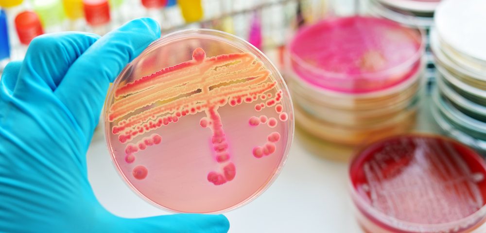 CF-associated Bacteria and Fungi Affect Each Otherâ€™s Growth, According to In Vitro Study