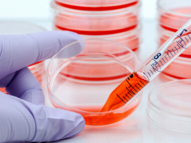 CF and disease severity