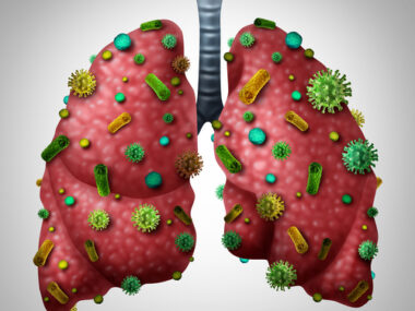 NTM infections, children and adolescents