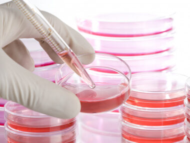 ELX-02 organoid study