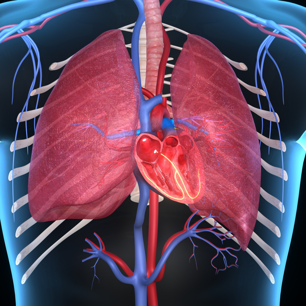 pulmonary hypertension and CF