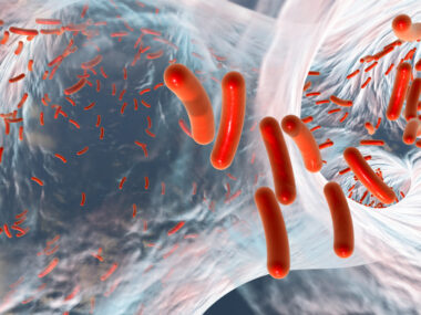 bacterial infections