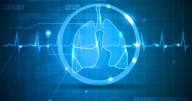 lung transplant