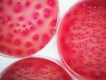 Kaftrio, CF treatment | Cystic Fibrosis News Today | cells in petri dish