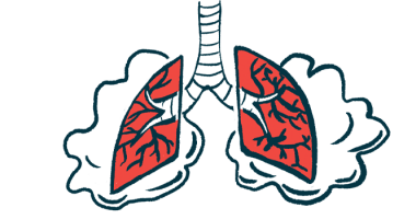 spergillus infection | Cystic Fibrosis News Today | inhaled antibiotics | illustration of lungs