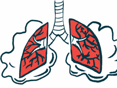 An illustration of human lungs.