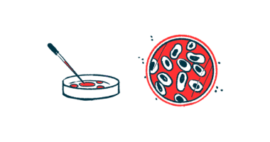 A dropper is poised over a petri dish alongside an aerial view of another petri dish filled with a sample.