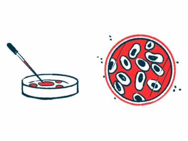 A dropper is seen poised over a petri dish alongside an aerial view of another petri dish filled with a sample.