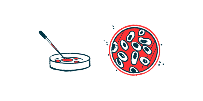 co-infection | Cystic Fibrosis News Today | illustration of cells in petri dish