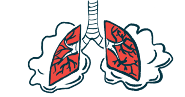 A pair of damaged lungs are seen with clouds behind them.