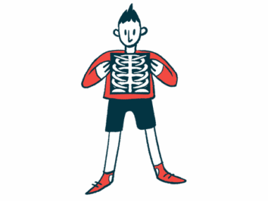 A person holds up a chest X-ray image showing the ribs and spine.