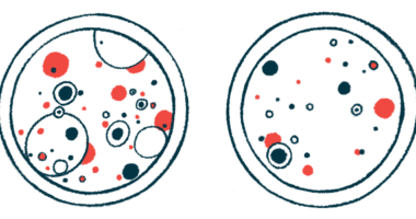 Two petri dishes with different bacteria levels are shown side by side.