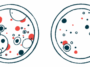 Two petri dishes with different bacteria levels are shown.