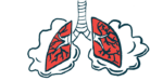 A close-up view of human lungs shows inflammation.