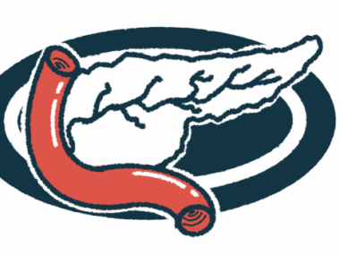 An illustration shows a pancreas.