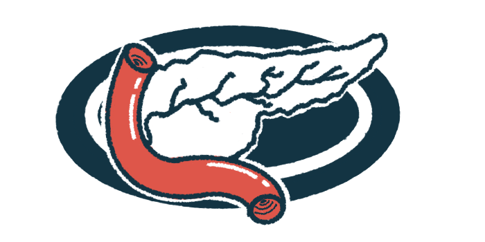 An illustration shows a pancreas.