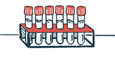 A rack of six clear vials with red caps.