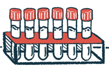 A rack of six clear vials with red caps.