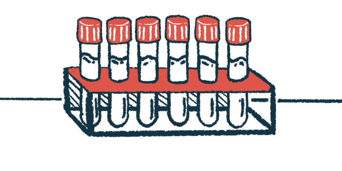 A rack of six clear vials with red caps.